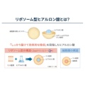 補足情報