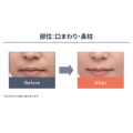 補足情報