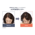 補足情報