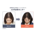 補足情報