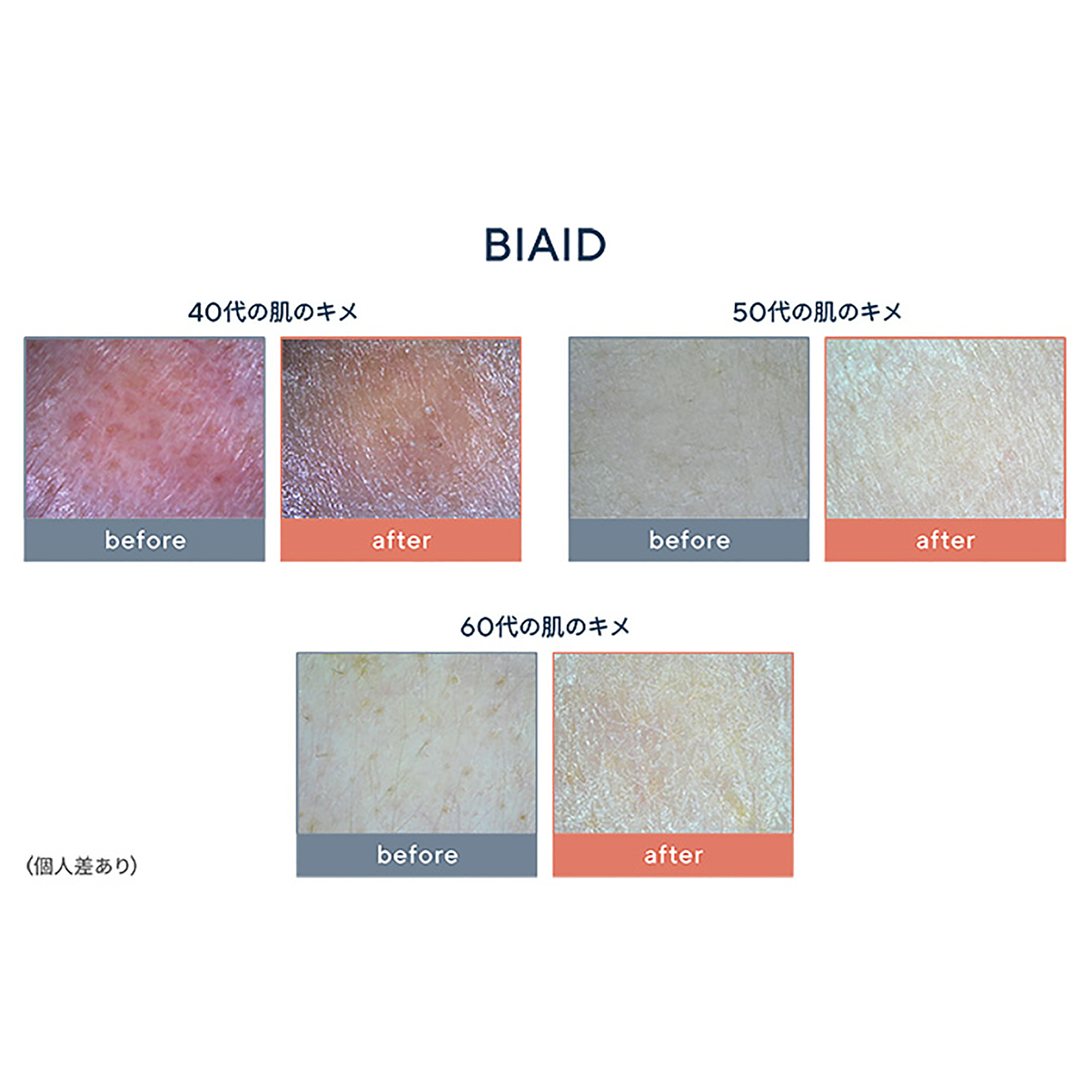 BIAID デュアルバイタルトリートメントエッセンス 2個セット - QVC.jp