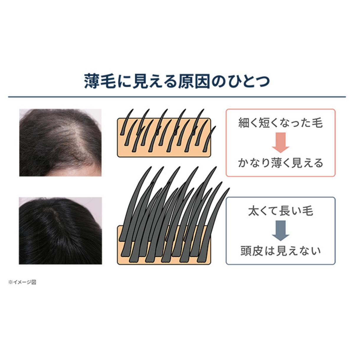正規品‼︎最新改良版リバイタラッシュ頭皮用・育毛剤