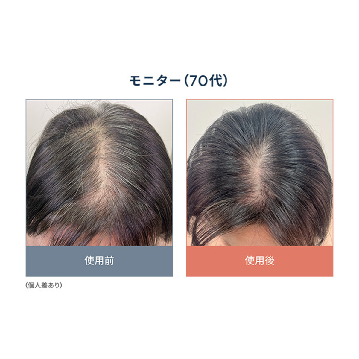 ヘアボーテエクラ薬用育毛スパークルセラムHG2本セット ヘアボーテ エクラ（HAIR BEAUTE ECLAT） - QVC.jp