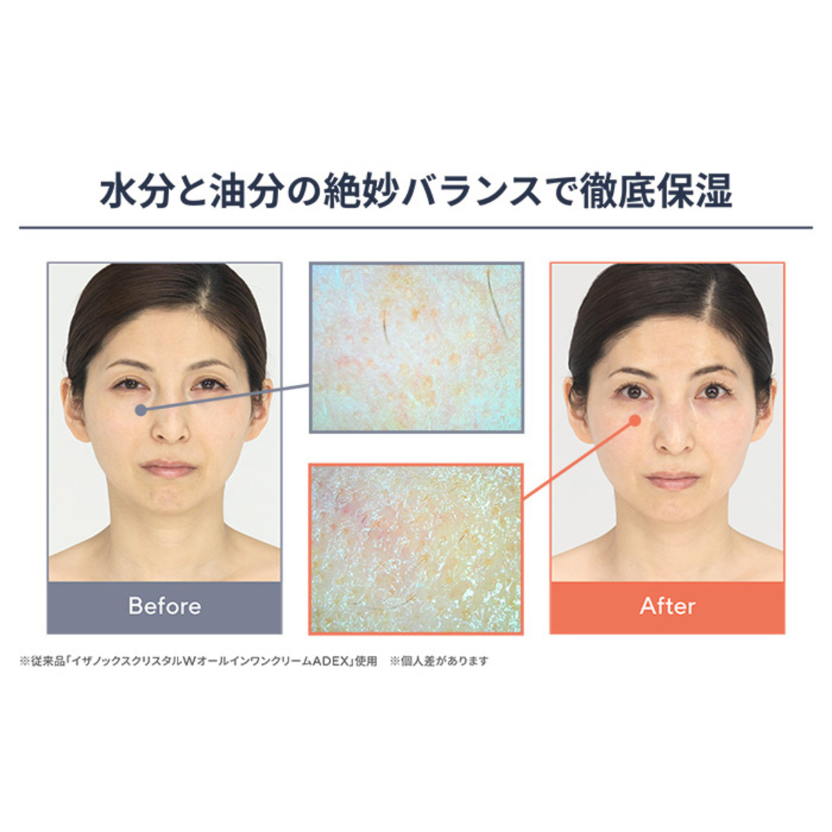 イザノックスクリスタルWオールインワンクリームADIV 4個特別セット