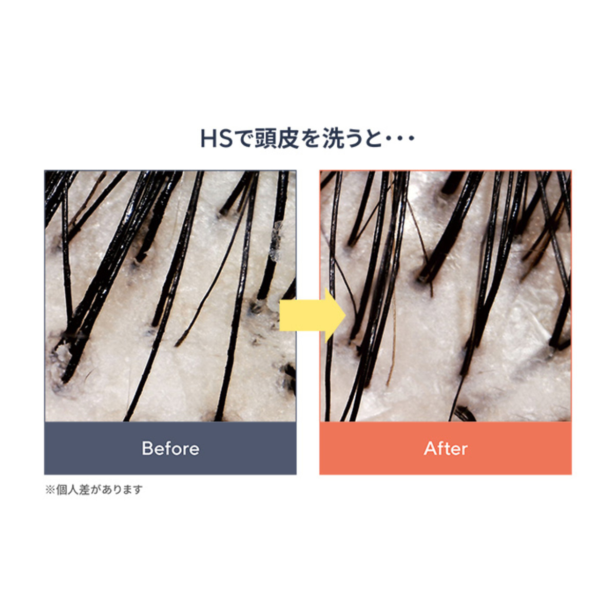 【未使用】アベックトワ バイタライジングHS 90g×4 J.AVEC TOI バイタライジングHS-III 4個セット ジェイアベックトワ（J
