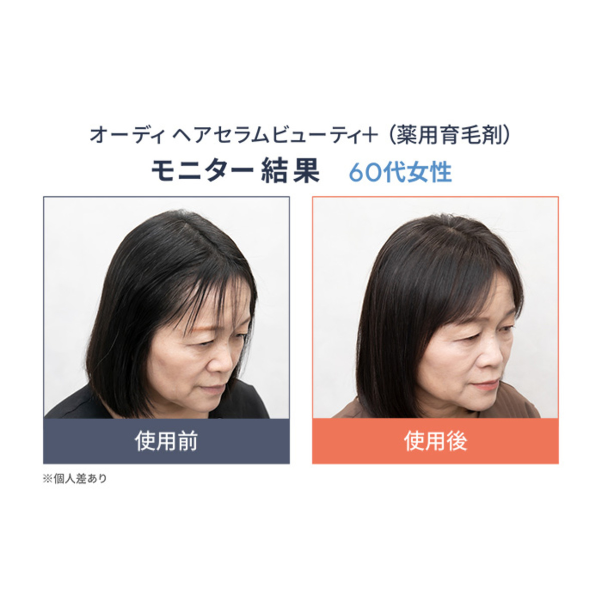 オーディヘアセラムビューティ+[薬用育毛剤]2本セット Ode（オーディ